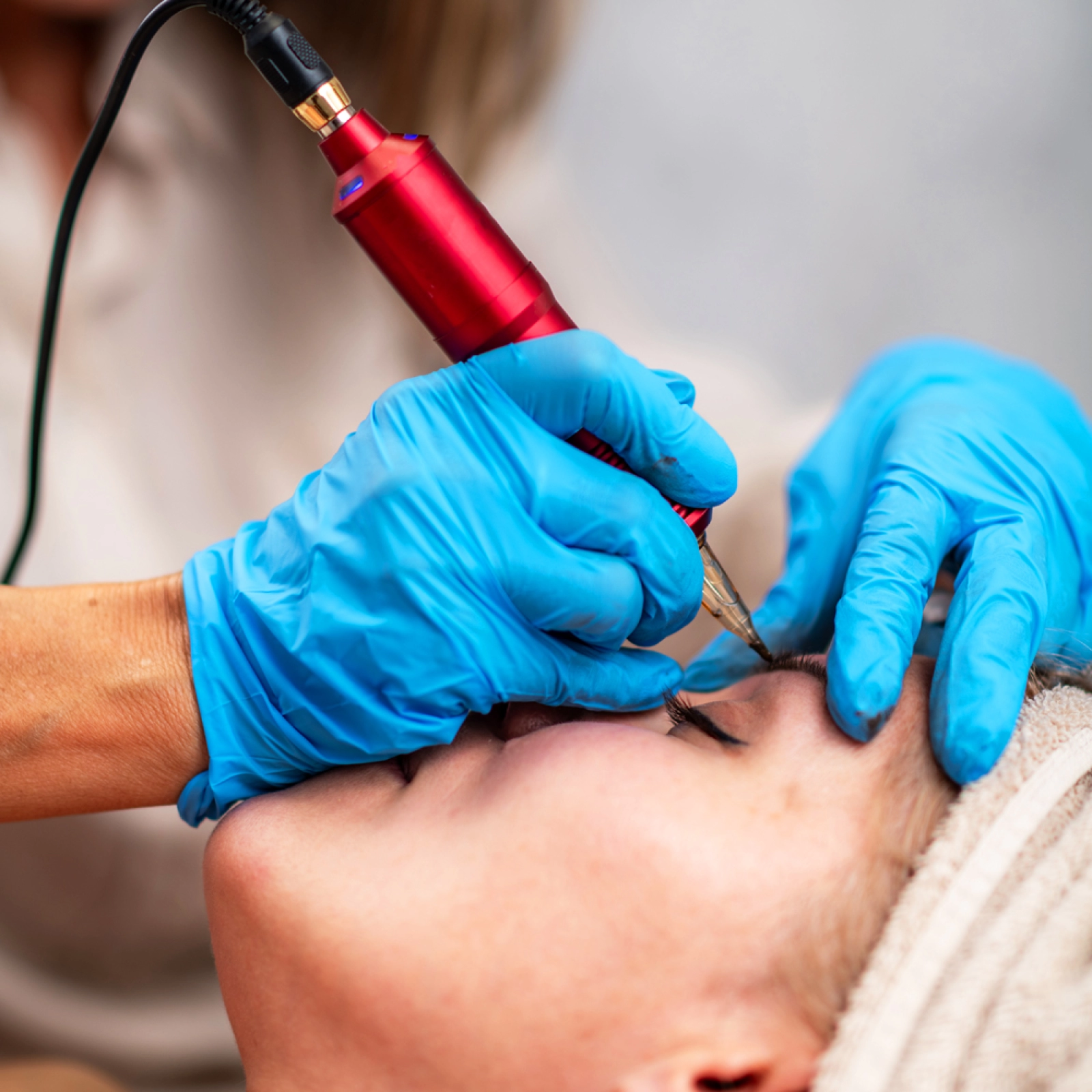MICRONEEDLING (viso e corpo)